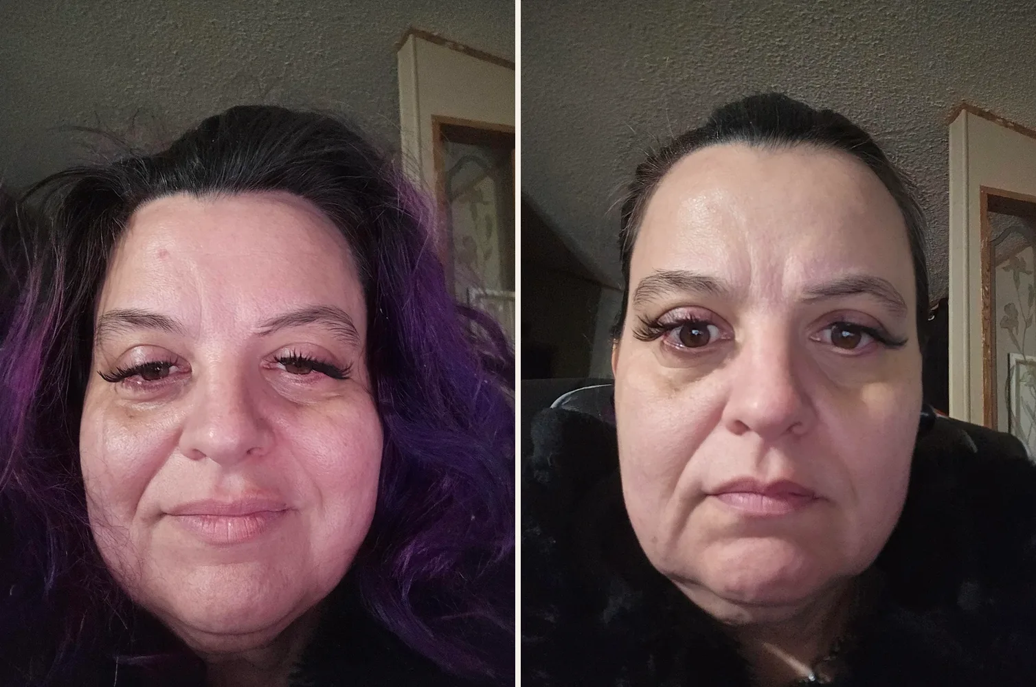 before and after, face